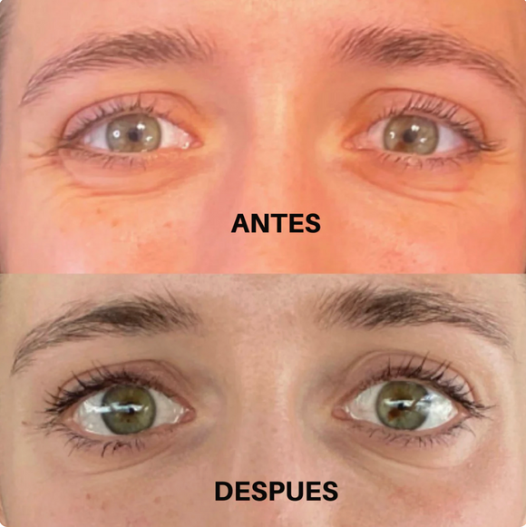 Feature product image